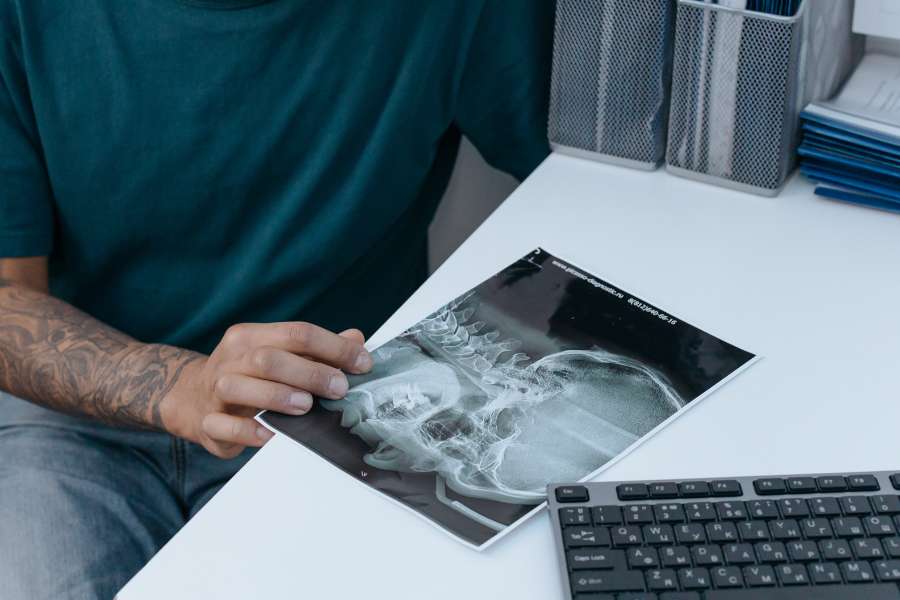 Contractura cervical: síntomas, causas y tratamiento