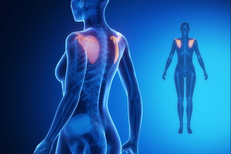 ¿Cómo prevenir el dolor entre las escápulas en el futuro?