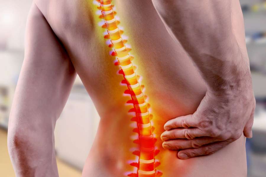 Hipercifosis: causas, síntomas y tratamientos efectivos