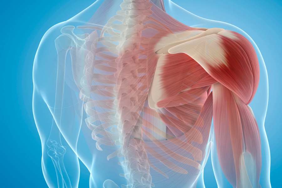 Dolor en el omoplato: 3 causas y tratamiento